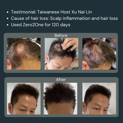 Zero2one